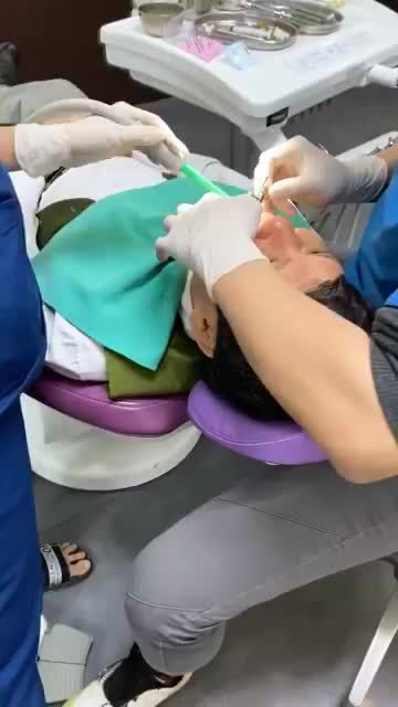 Ca phục hình răng sứ sau khi cắm Implant tại Shinbi Dental