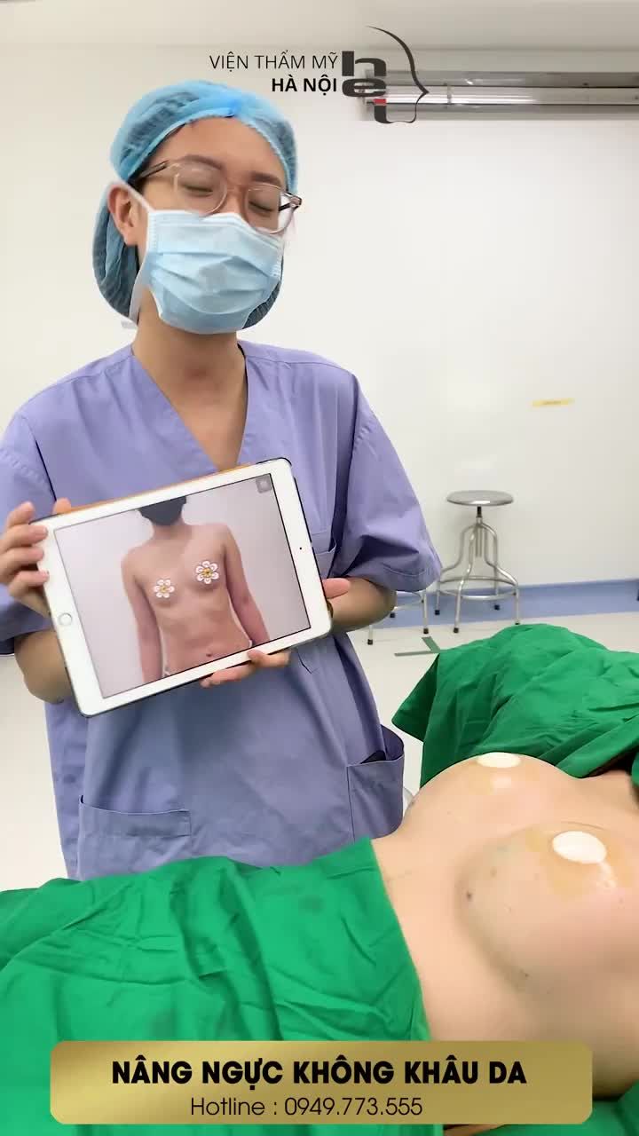 Kết quả ngay sau khi thực hiện Nâng ngực không khâu da của chị khách hàng cùng Ts.Bs Mai Mạnh Tuấn và ekip của Viện thẩm mỹ Hà Nội tại bệnh viện đạt chuẩn của Bộ Y tế.