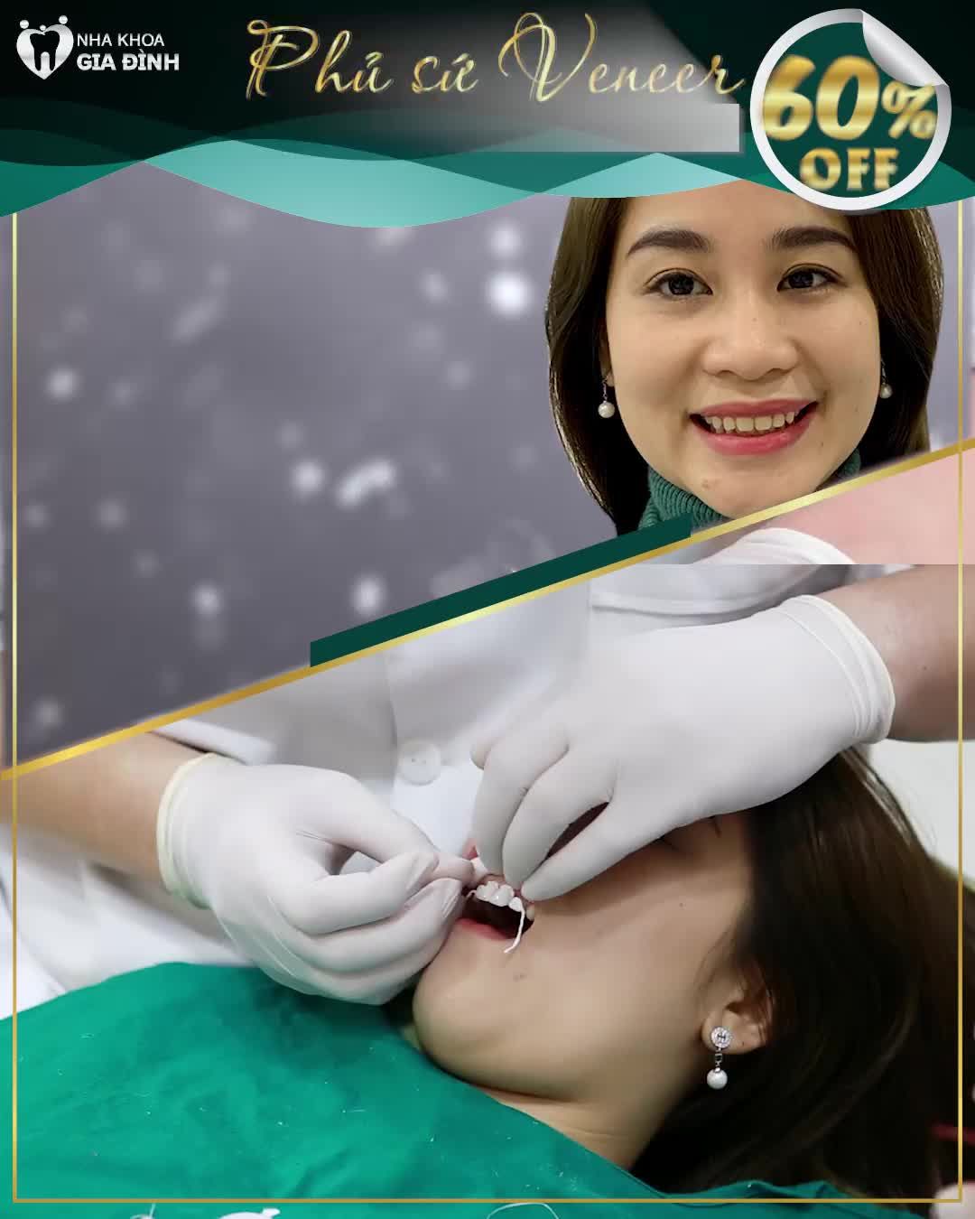 DÁN SỨ VENEER CHỈ TỪ 3TR/RĂNG – HỖ TRỢ 100% CHI PHÍ ĐI LẠI