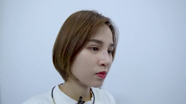 MŨI SOFTLINE sau 8 ngày thực hiện - càng ngắm càng phê