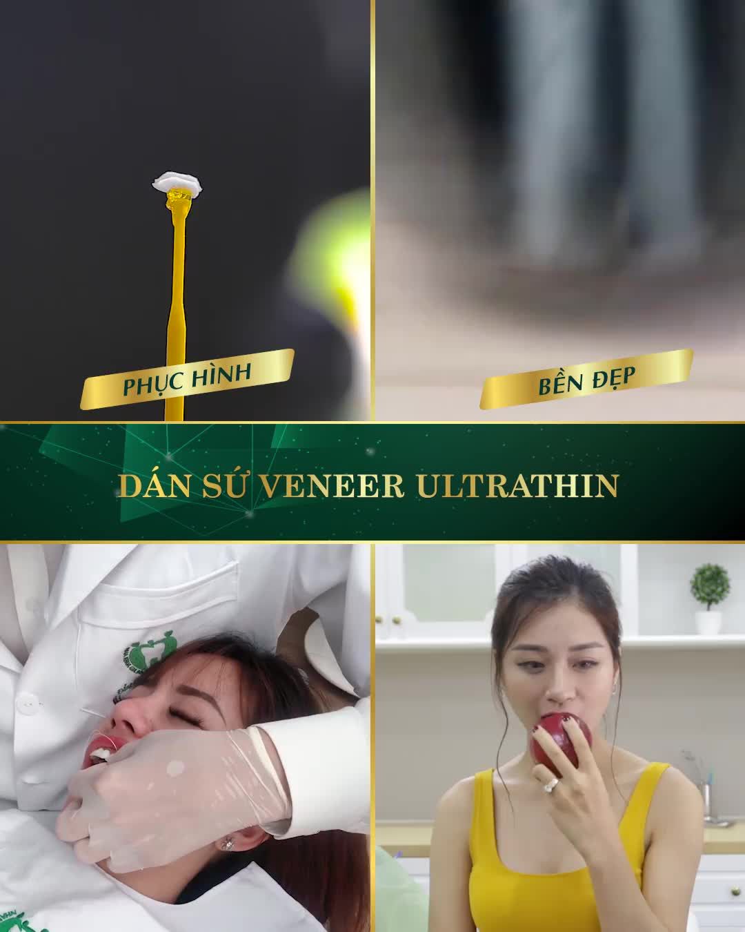 TẠM BIỆT: sứt mẻ - sâu kẽ, thưa - hô nhẹ, nhiễm màu kháng sinh, xỉn màu không thể tẩy trắng... chỉ sau 2 lần thăm khám