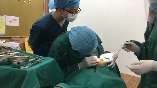 Cấy implant răng cửa cho bạn Thanh Giang.