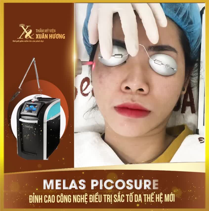 ĐỪNG VÌ THẤY CHÀM BỚT KHÓ XÓA MÀ XÁC ĐỊNH CẢ ĐỜI PHẢI "SỐNG CHUNG"