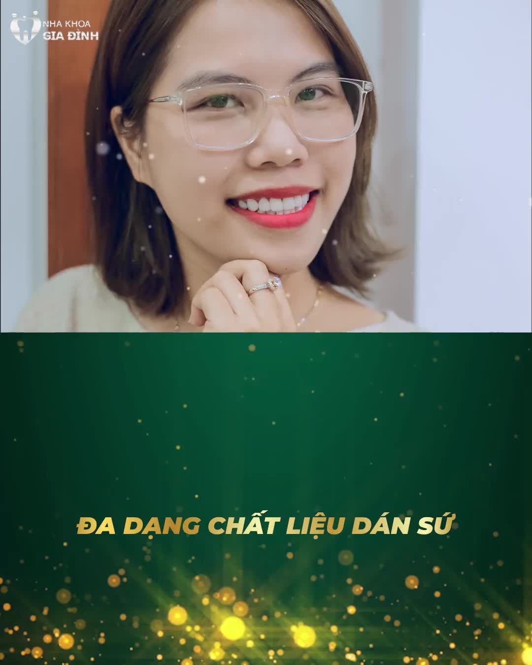 ƯU ĐIỂM VƯỢT TRỘI CỦA DÁN SỨ VENEER