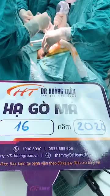 Ca hạ gò má số 16 năm 2020