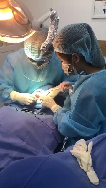 CẬN CẢNH PHÒNG CẮM GHÉP IMPLANT