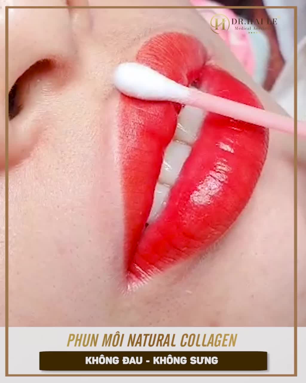 PHUN MÔI NATURAL COLLAGEN, Vũ khí Tân trang nhan sắc của PHÁI ĐẸP.