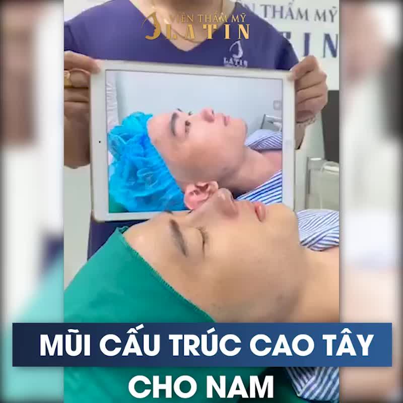 MŨI CẤU TRÚC MEGADERM DÁNG CAO TÂY CHO NAM GIỚI