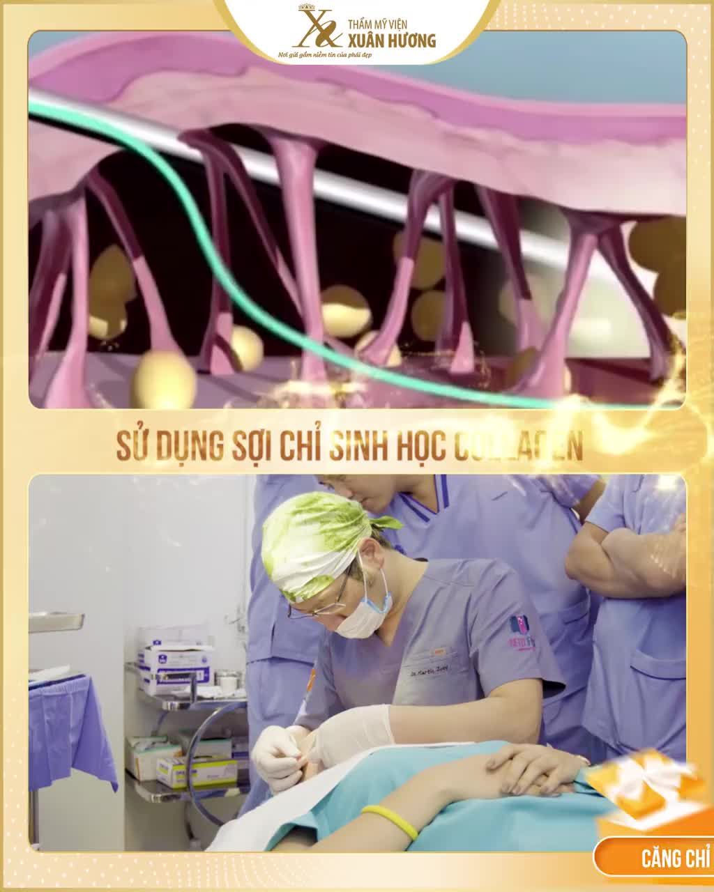 TRẺ HÓA DA KHÔNG XÂM LẤN - CẬP NHẬT NGAY XU HƯỚNG LÀM ĐẸP 2020