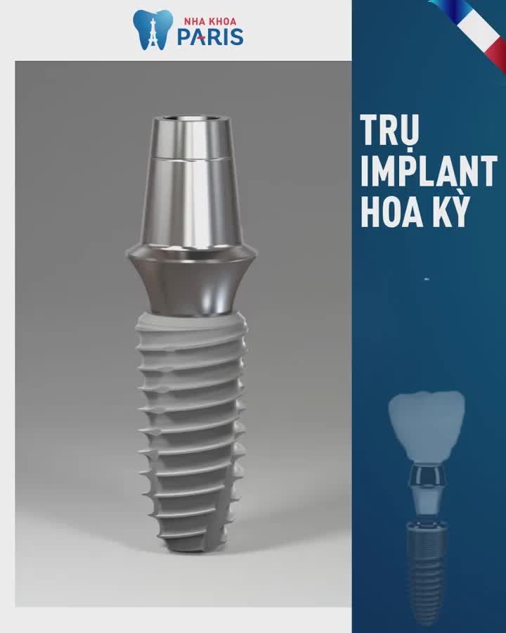 TRỒNG RĂNG IMPLANT - AN TOÀN CHUẨN PHÁP