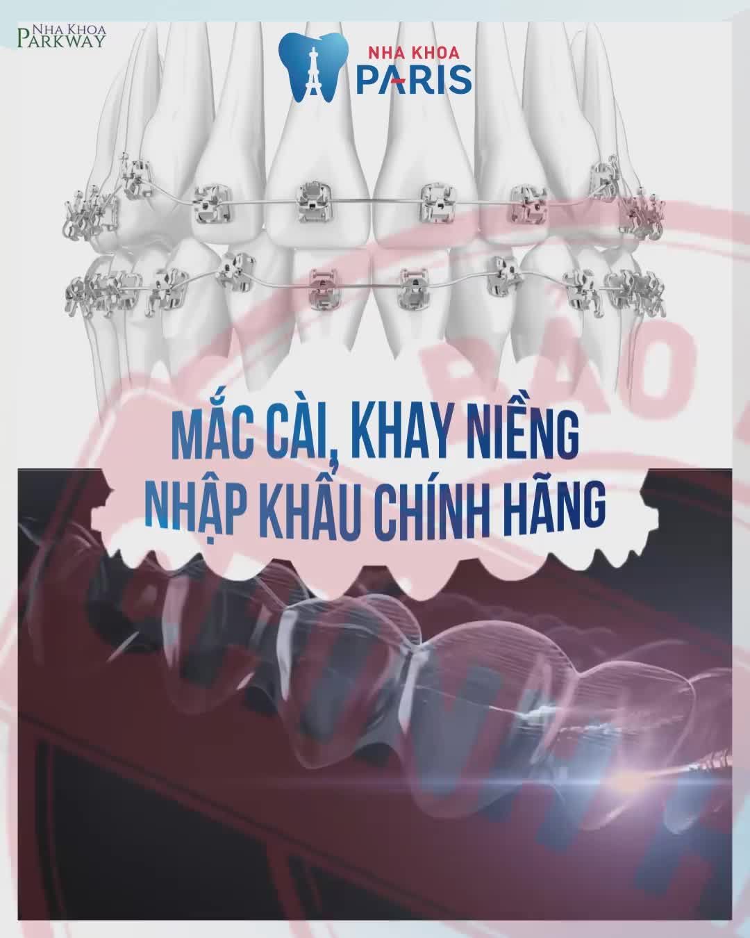 NIỀNG RĂNG 3D SPEED - RÚT NGẮN 6 THÁNG ĐEO NIỀNG