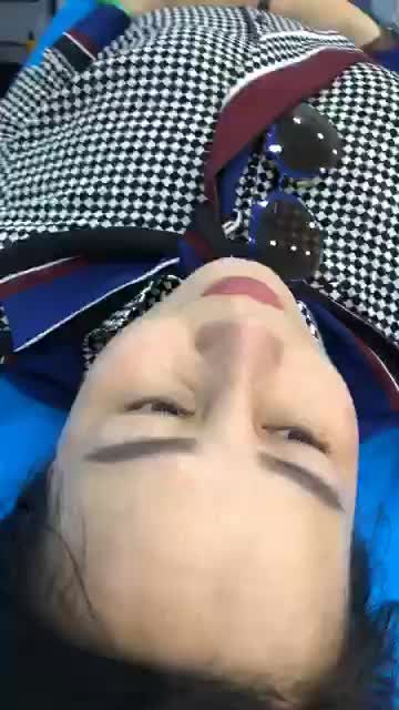 Tái khám sau 16 ngày. Nâng Mũi Bán Cấu Trúc Đa Lớp Mũi ôm dáng, đầu mũi bay tròn, phong thuỷ. Kỹ thuật độc quyền Bác Sĩ KỲ Y Dược