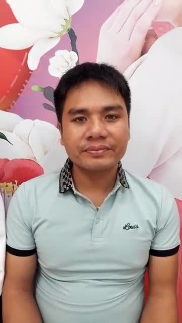 Kh phẩu thuật sẹo môi tái khám 1 tháng.