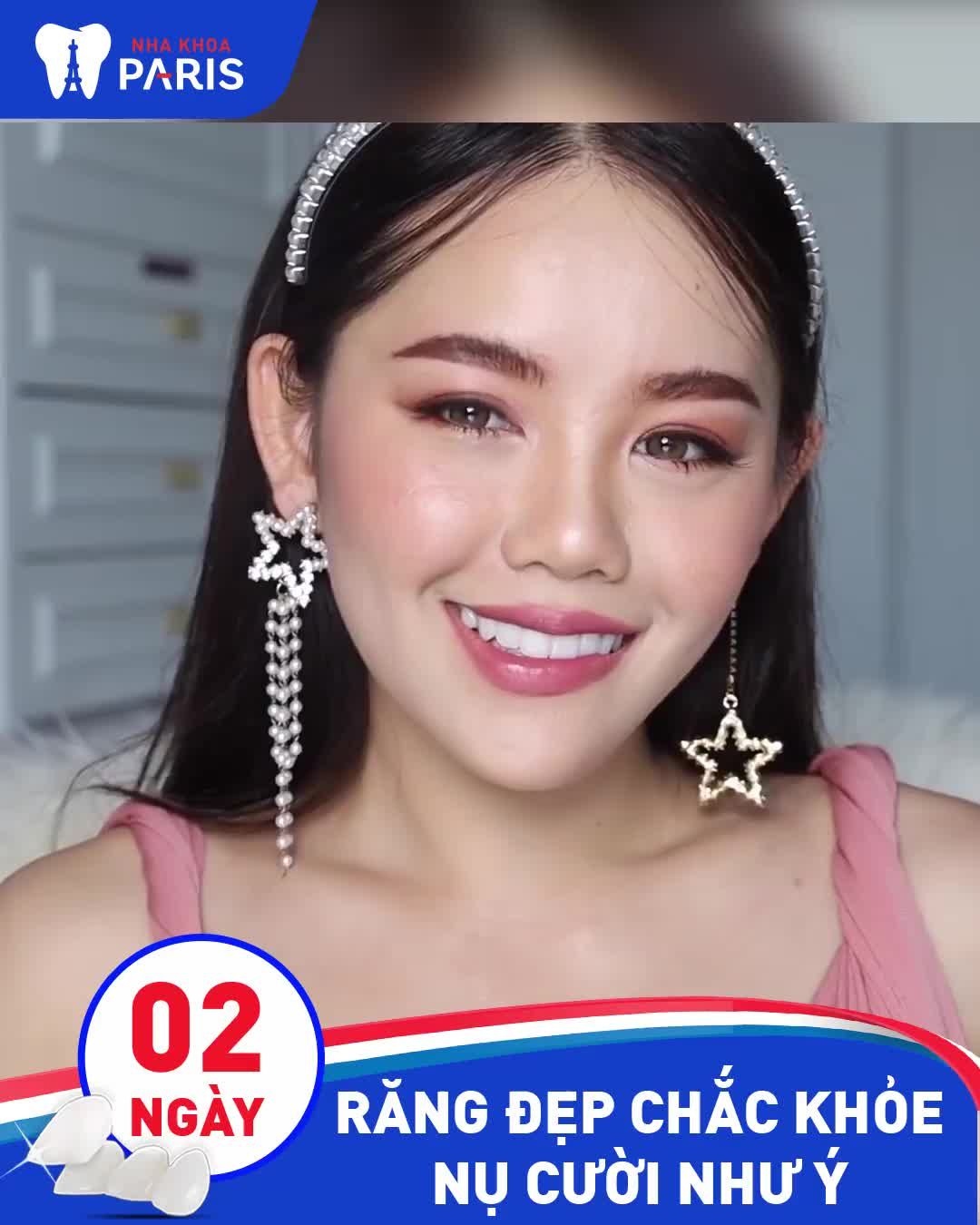 BỌC RĂNG SỨ  NỤ CƯỜI MỚI  THÀNH CÔNG MỚI