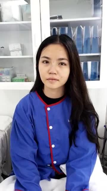 Kết quả ngay sau Nâng mũi cấu trúc 4D siêu âm tại Kangnam