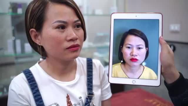 MẮT CHUẨN 2 MÍ - ĐẬP TAN TỰ TI Cùng chiêm ngưỡng kết quả cắt mí sau 19 ngày!