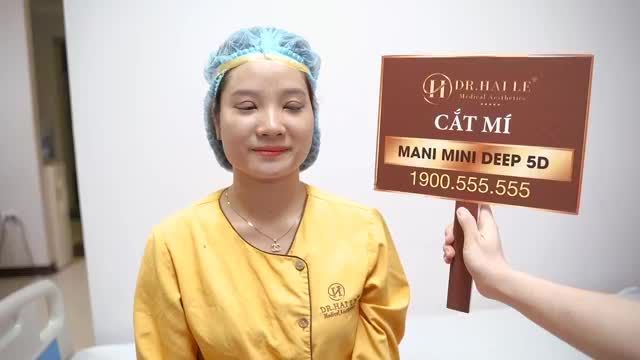 "Chưa bao giờ em nghĩ đôi mắt của em lại thay đổi như thế này" Chia sẻ của bạn khách hàng sau khi cắt mí tại Dr.Hải Lê