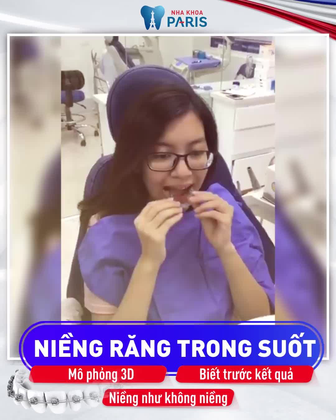 Niềng Răng Trong Suốt 3D Speed  Mặt Cân Đối  Cằm Vline