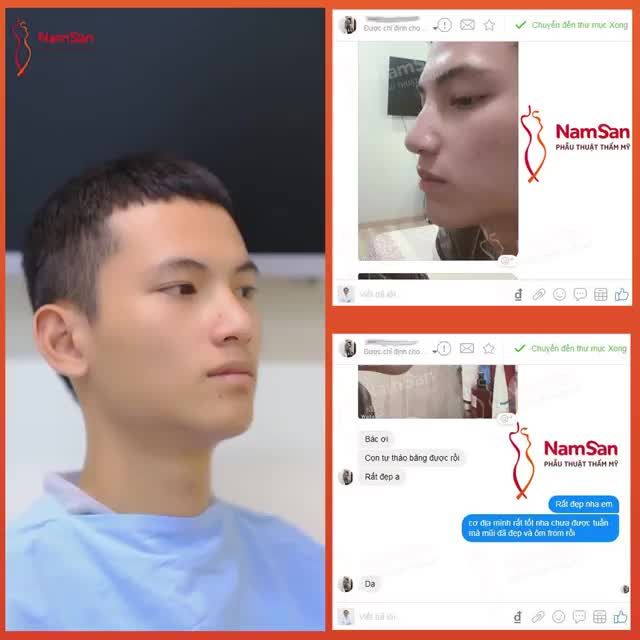 DÁNG MŨI NAM THẦN  SIÊU BAY  SIÊU HÀI HOÀ