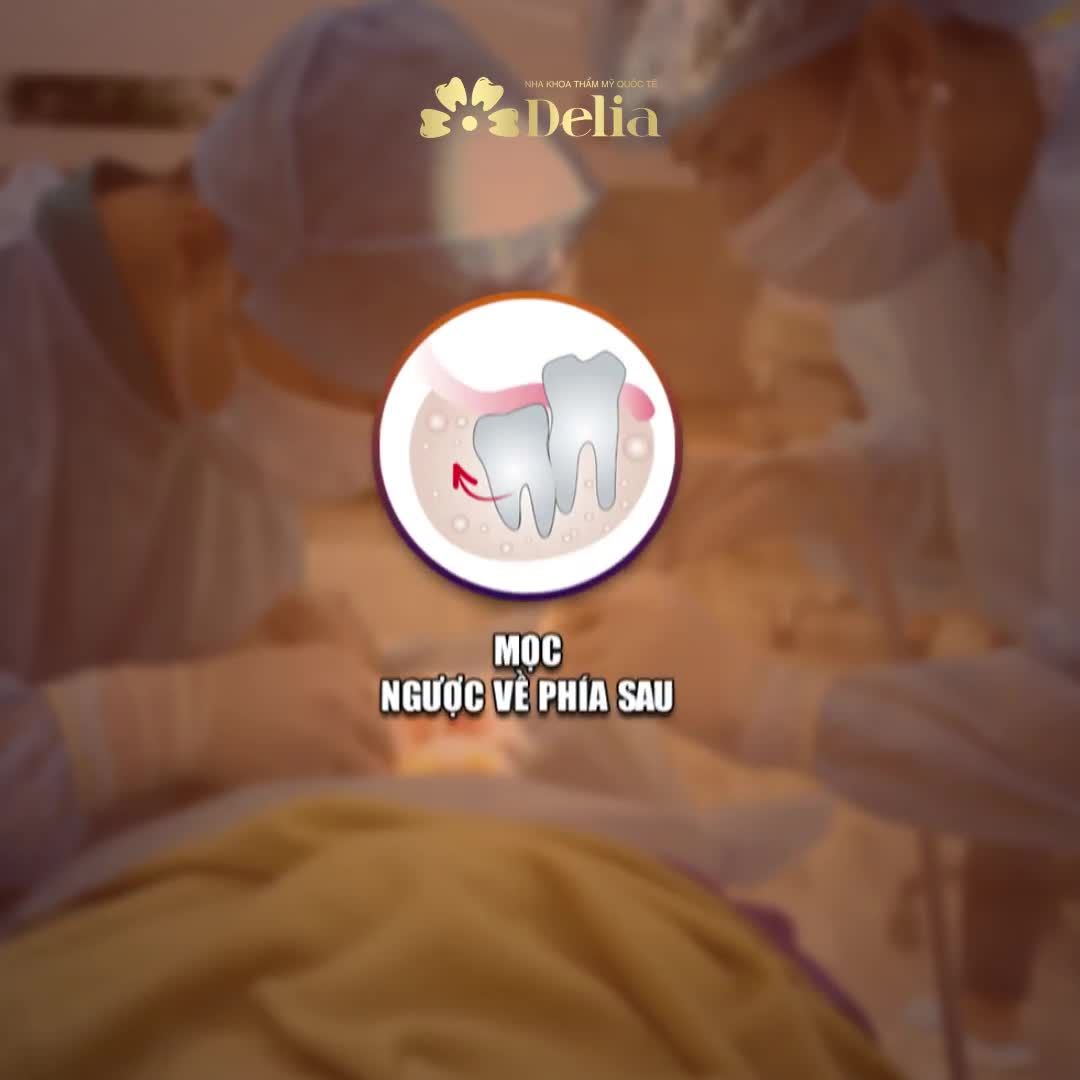 TẠI SAO 85% TRƯỜNG HỢP RĂNG KHÔN CẦN PHẢI NHỔ BỎ?  NẾU KHÔNG NHỔ RĂNG KHÔN GÂY RA NHỮNG BIẾN CHỨNG NÀO?