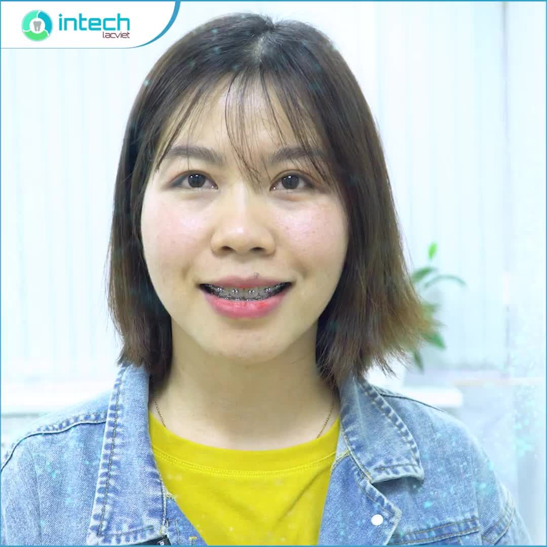 Thành quả "xứng đáng" sau 2 năm niềng răng kiên trì, gắn bó với NHA KHOA LẠC VIỆT INTECH của bạn Trần Thị Quyên 28 tuổi.