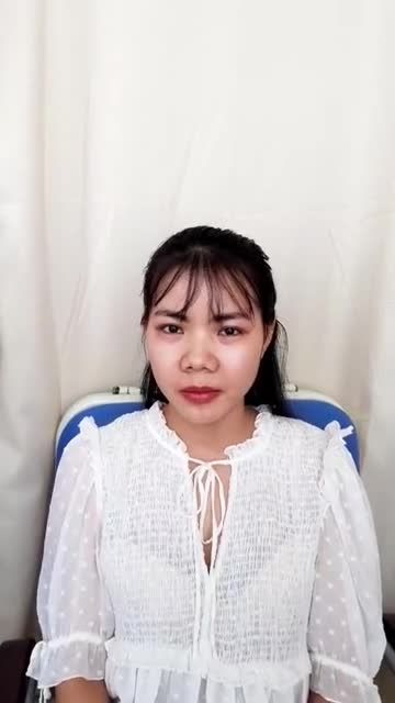 Hàm hô + Cằm lẹm nữ 9X ước mơ thẩm mỹ ngay từ tuổi dậy thì