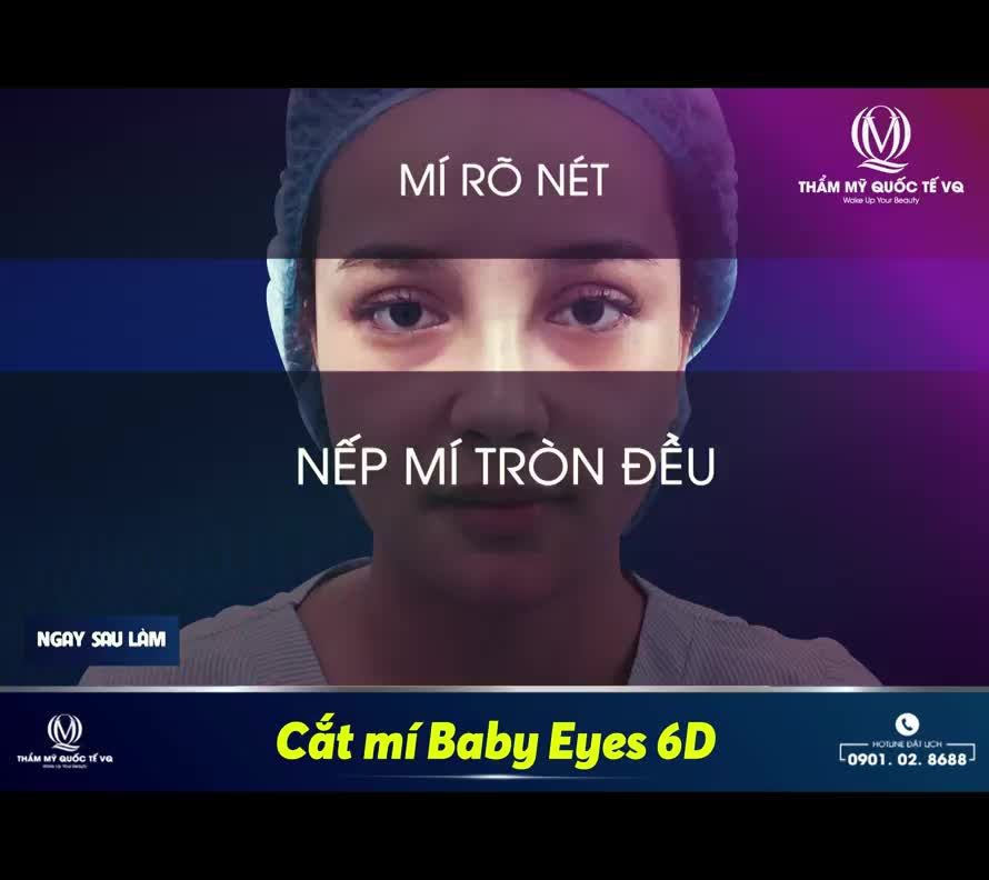 30' để tạm biệt vĩnh viễn đôi mắt buồn ngủ - bạn nghĩ sao ?