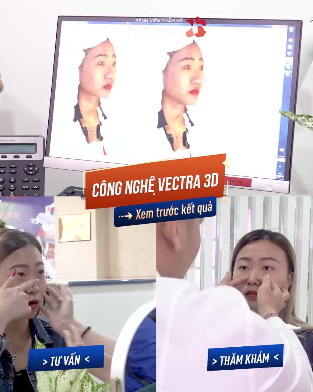 Mặt có nét nhưng MŨI TẸT, cô nàng Việt Kiều Úc quyết định vượt 5000km về Việt Nam Nâng mũi và được bác sĩ tư vấn Nâng mũi cấu trúc 4D Nanoform?
