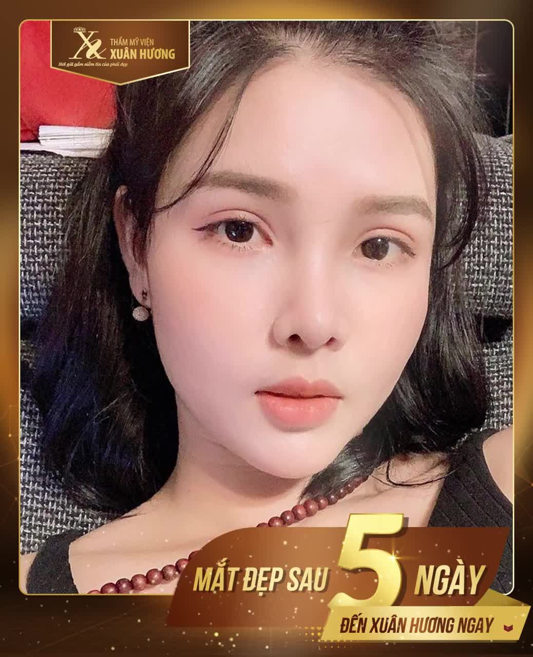 3 LÍ DO KHIẾN THẨM MỸ MẮT TẠI TMV XUÂN HƯƠNG LUÔN KHẲNG ĐỊNH ĐƯỢC VỊ THẾ TOP 1 NGÀNH THẨM MỸ!