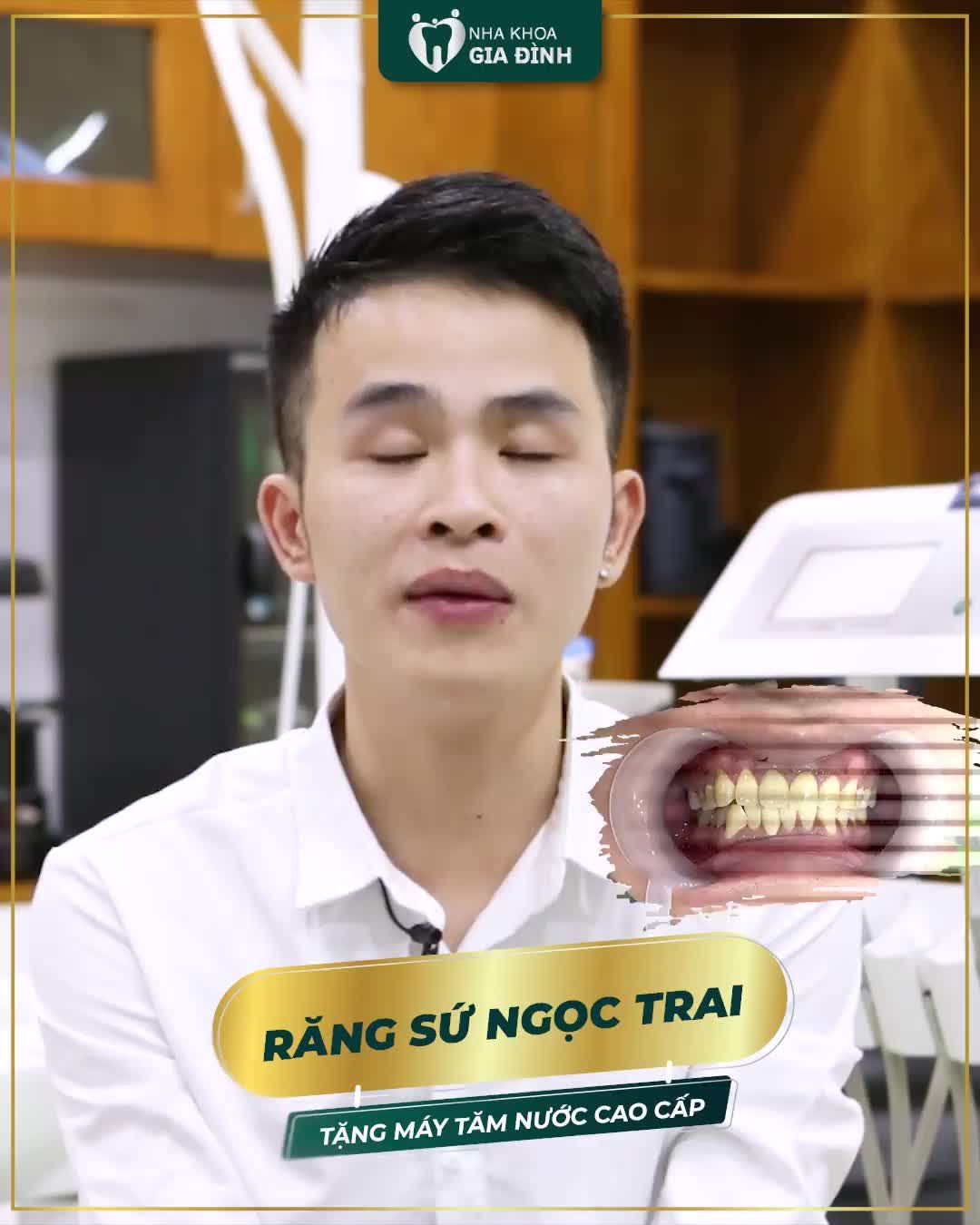THẨM MỸ RĂNG – KHẮC PHỤC HOÀN TOÀN TÌNH TRẠNG Ố VÀNG DO THUỐC LÁ
