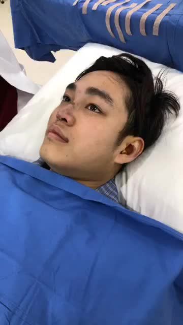 Nẹp mũi cố định đang mũi không bị lệch sau nâng mũi Cấu trúc 4D