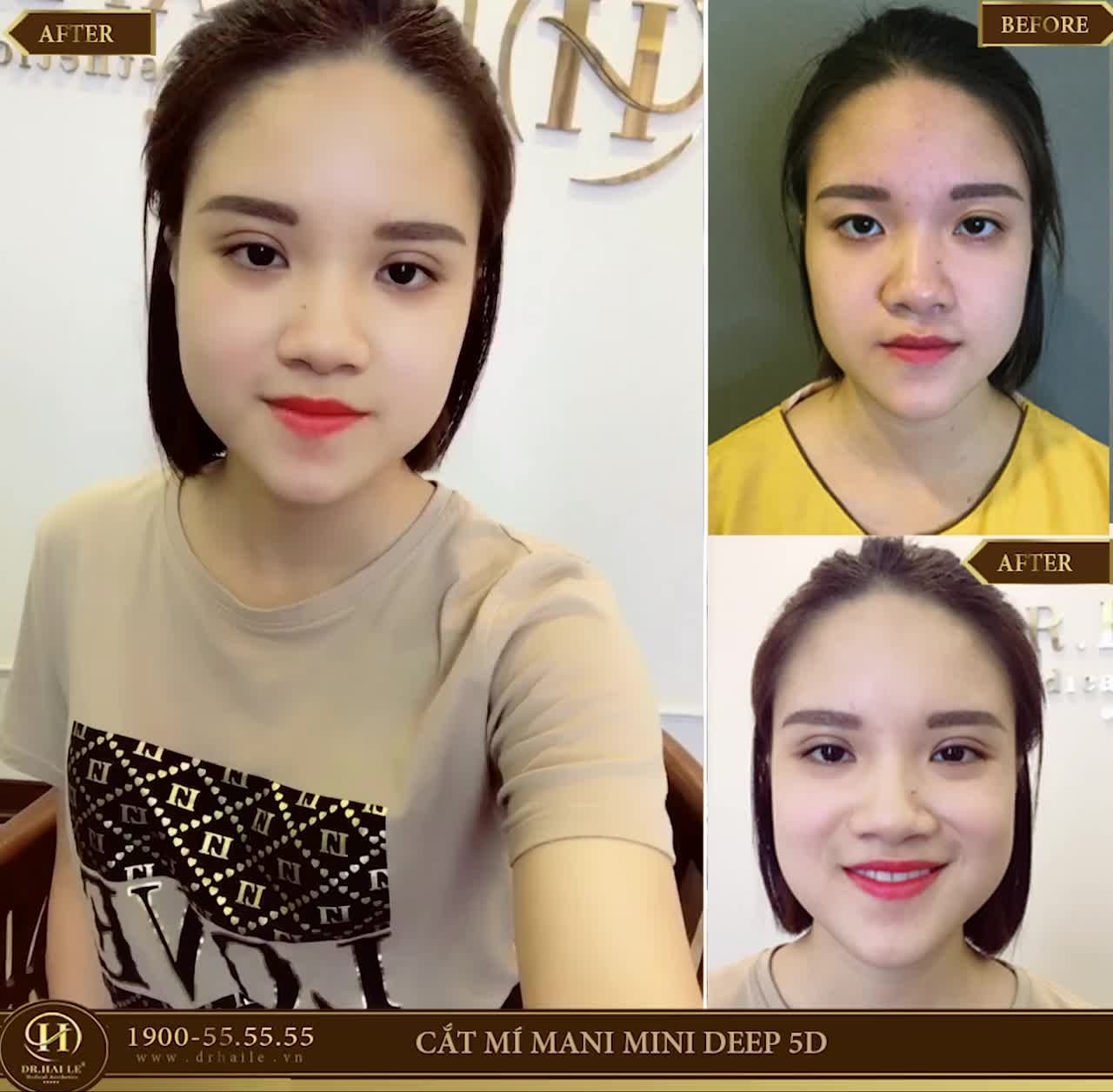 Ưu đãi THÁNG 3 có ngay MÍ "siêu xinh" CHỈ TỪ 7tr5  Sao có thể bỏ lỡ️⁉ Duy nhất hôm nay ngày 21/3/2020