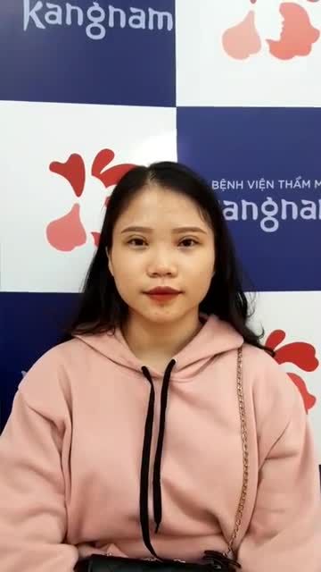 Khách hàng tái khám cắt mí trên plasma tạo khóe trong tái khám 3 tháng.