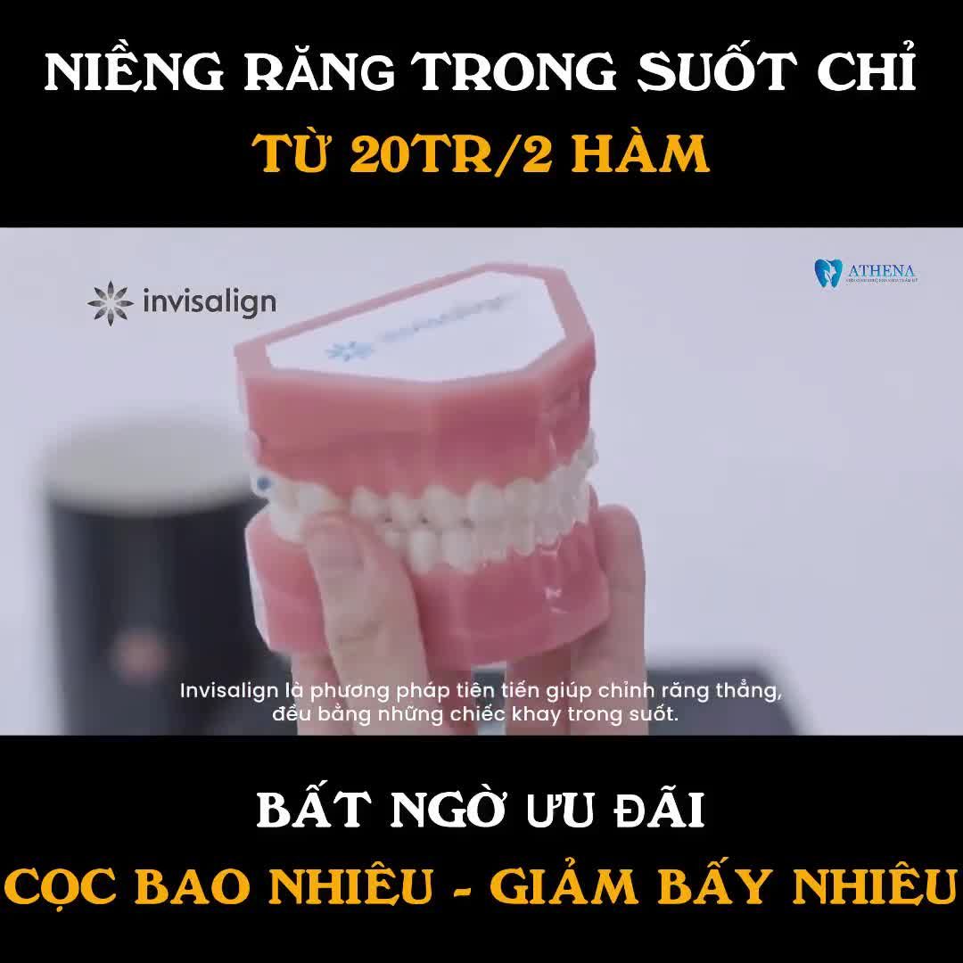 ĐAU ĐÁU TRONG LÒNG  CHI PHÍ NIỀNG RĂNG