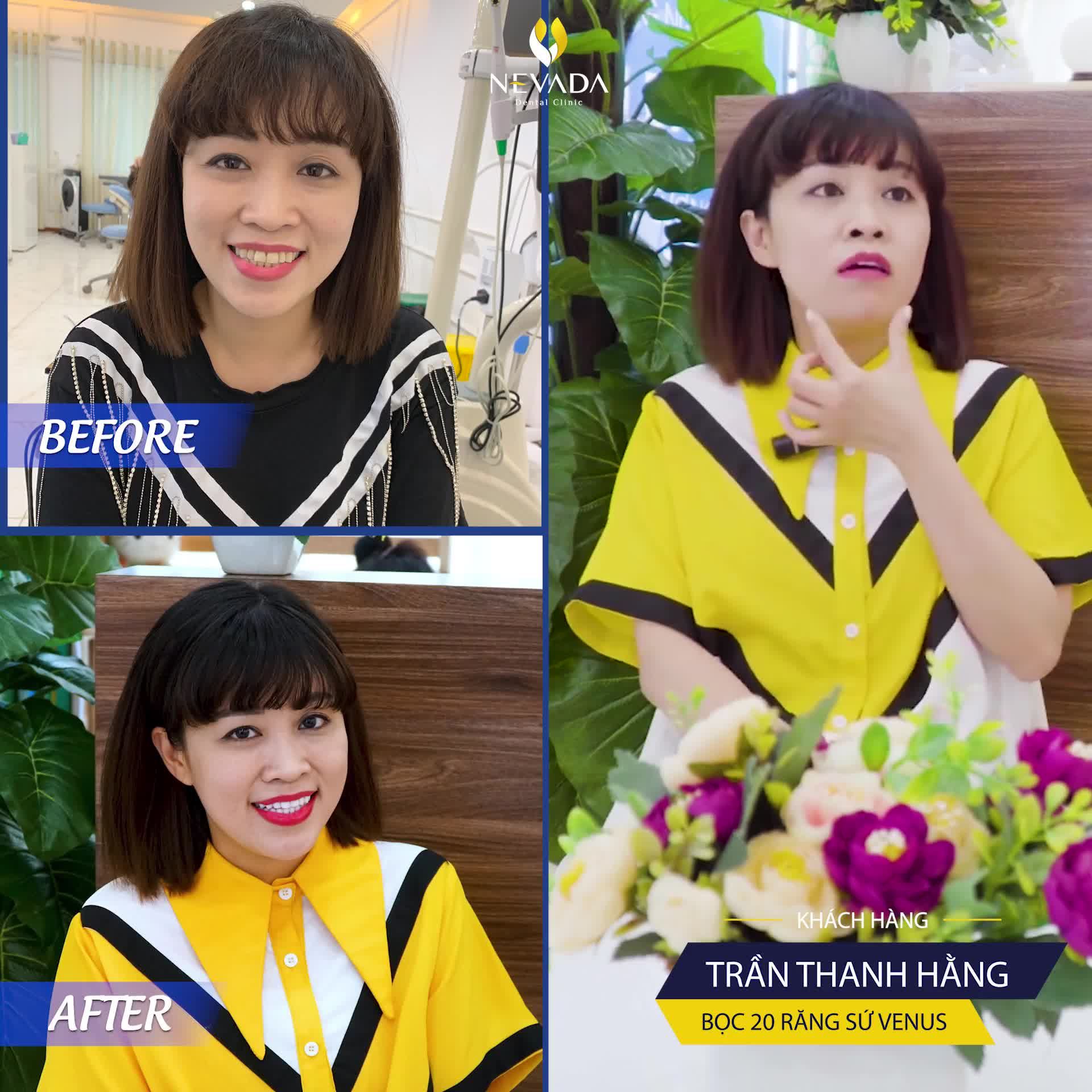 LỘT XÁC NỤ CƯỜI CÙNG NEVADA