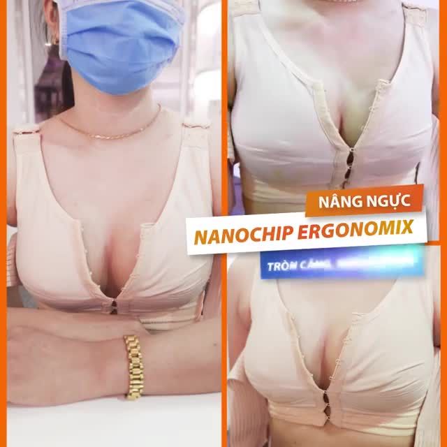 Nâng nguc Nanochip Ergonomix - Tròn căng, sexy, hút mắt