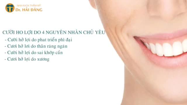 NGUYÊN NHÂN VÀ CHỈ ĐỊNH CHỮA CƯỜI HỞ LỢI TRONG NHA KHOA