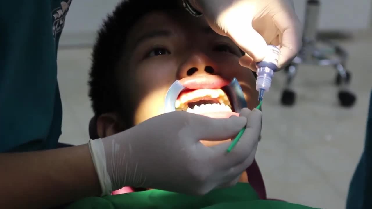 NIỀNG RĂNG CÓ LÀM RĂNG YẾU ĐI