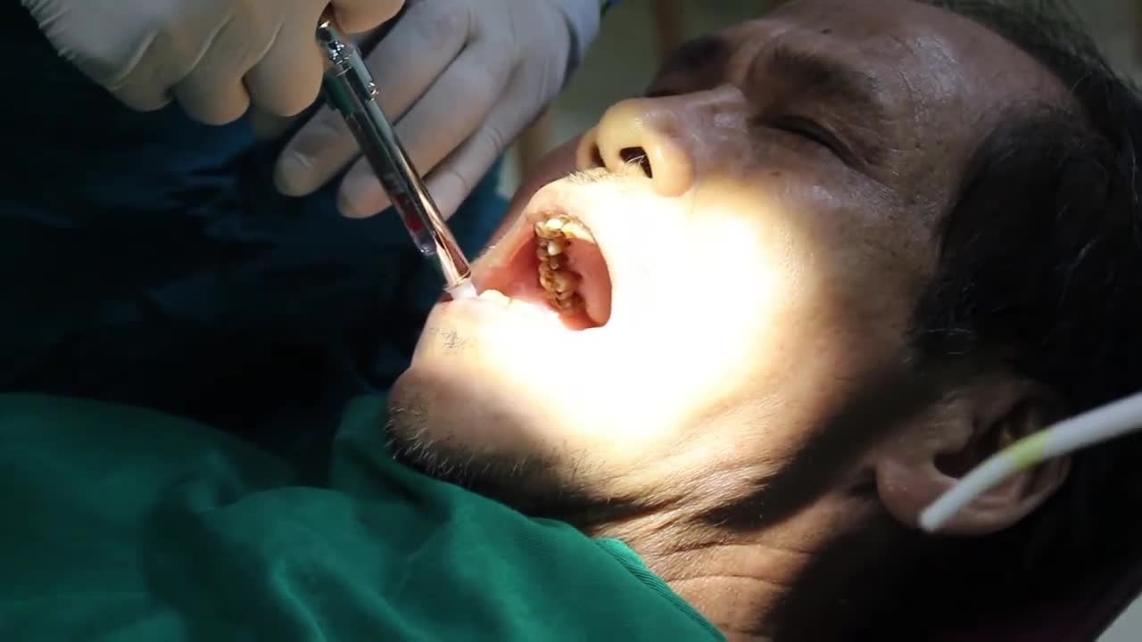 TRỒNG RĂNG IMPLANT CHO NGƯỜI CAO TUỔI CÓ NGUY HIỂM KHÔNG