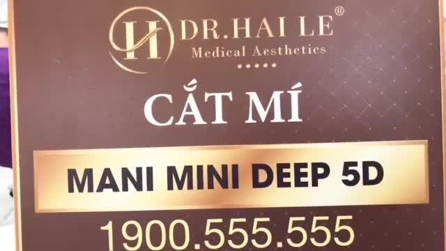 Kết quả cắt mí - Thay đổi hoàn toàn đôi mắt u buồn cho khách hàng sau 40 phút cắt mí Mani Mini Deep 5D.