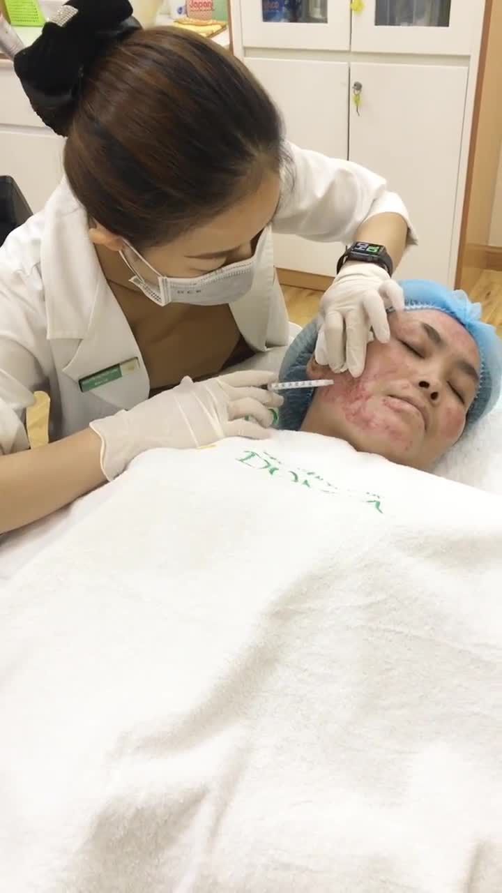 Cứu chữa làn da SẸO BỎNG CỰC NẶNG của chị khách hàng tới từ Bình Dương