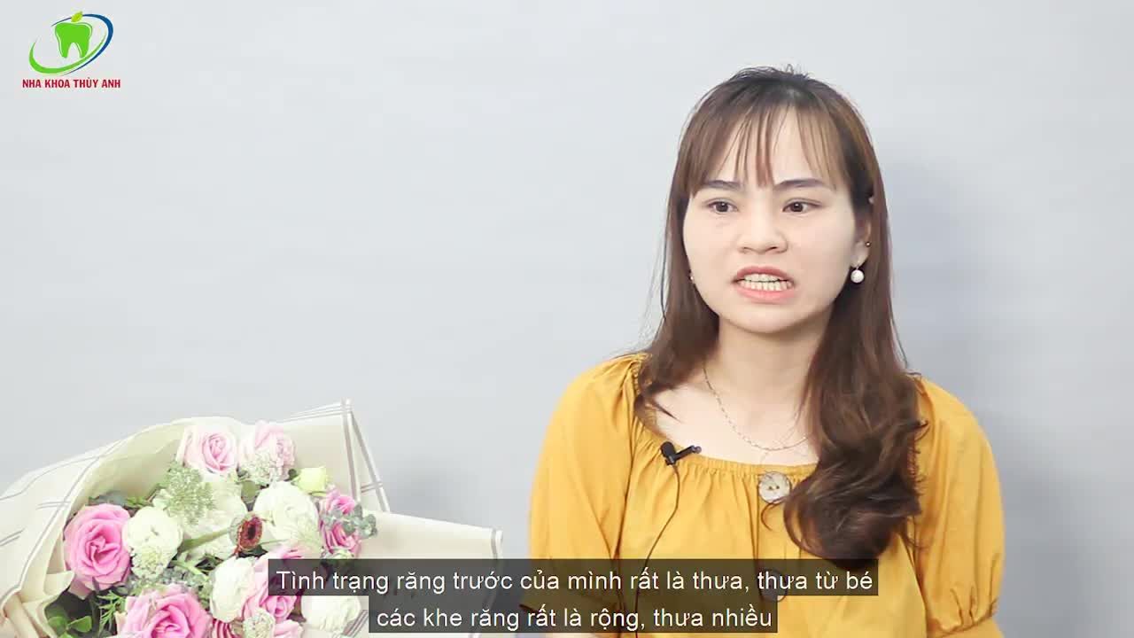 CÂU CHUYỆN NHA KHOA - CẢM NHẬN SAU NIỀNG RĂNG