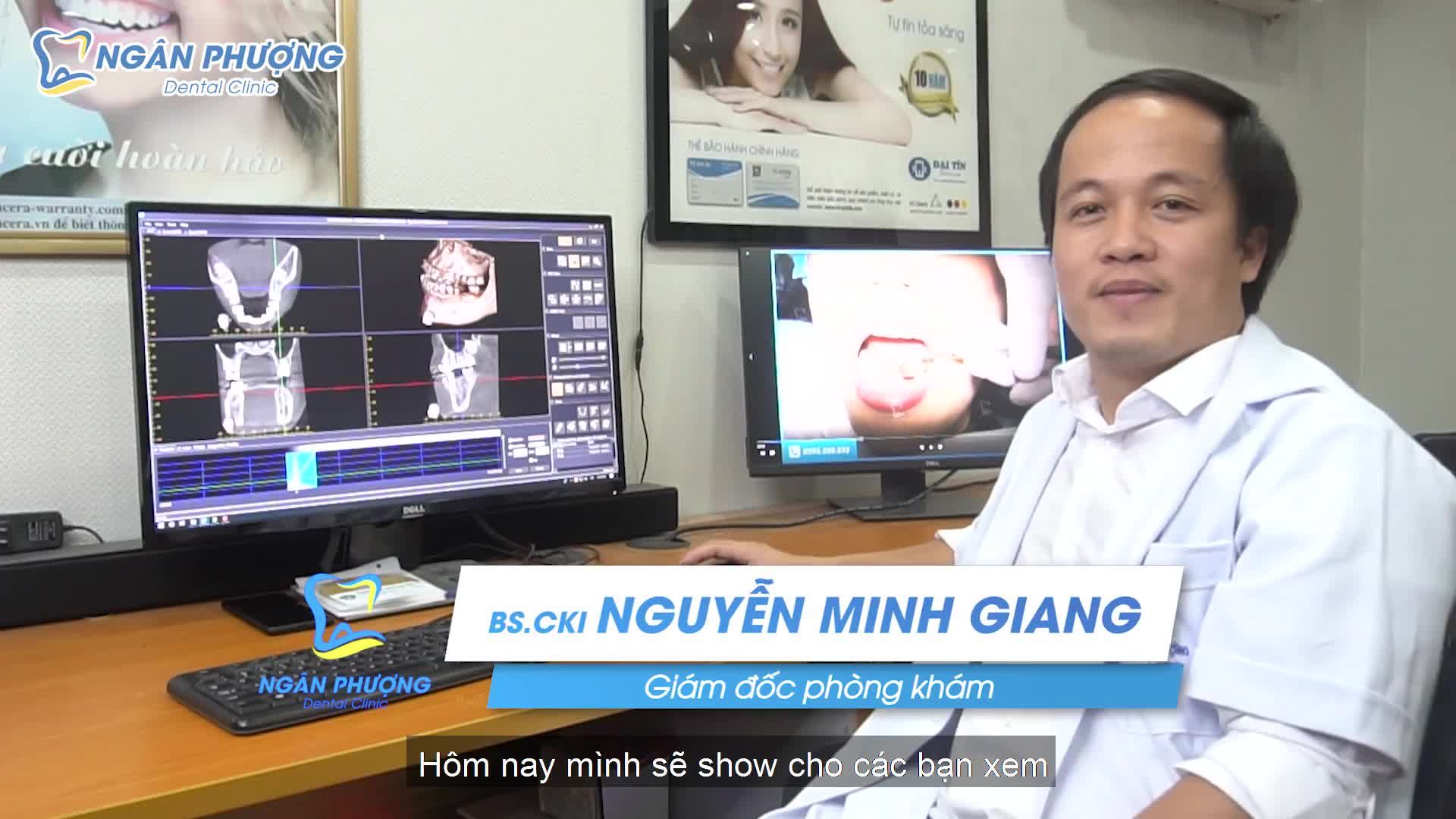 Bạn có bao giờ thắc mắc, trước khi đưa ra quyết định trồng Implant, bác sĩ làm việc như thế nào?