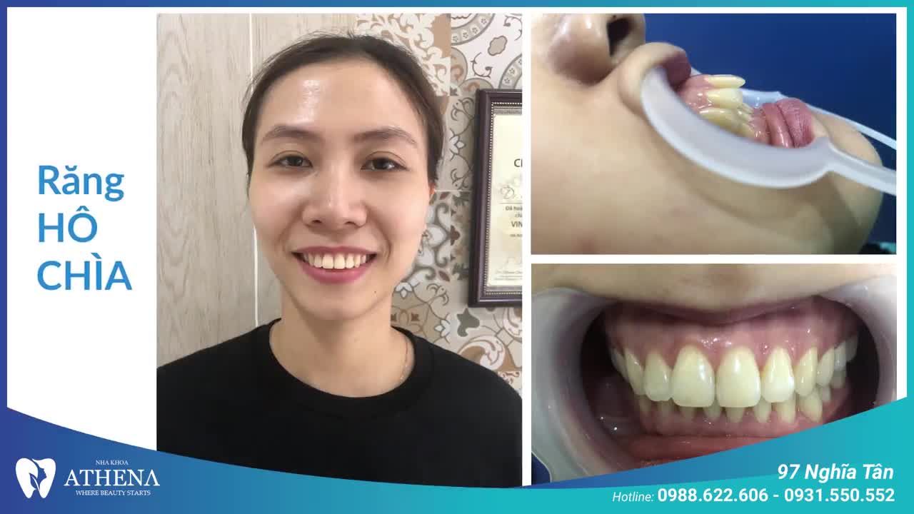 Chị Nguyễn Minh Tâm vui vẻ chia sẻ trong một buổi tái khám của mình.