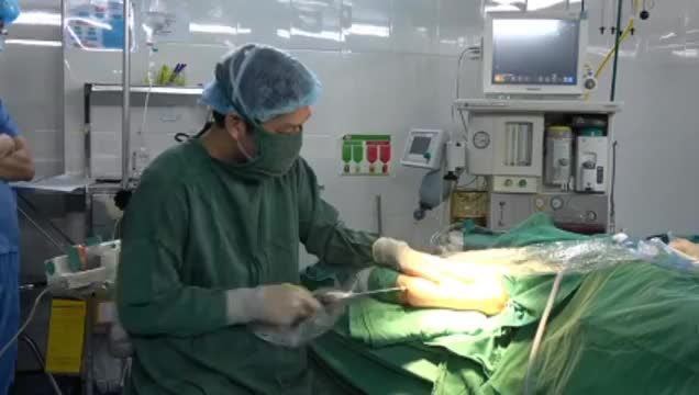 Hút mỡ cánh tay - Thon gọn, săn chắc