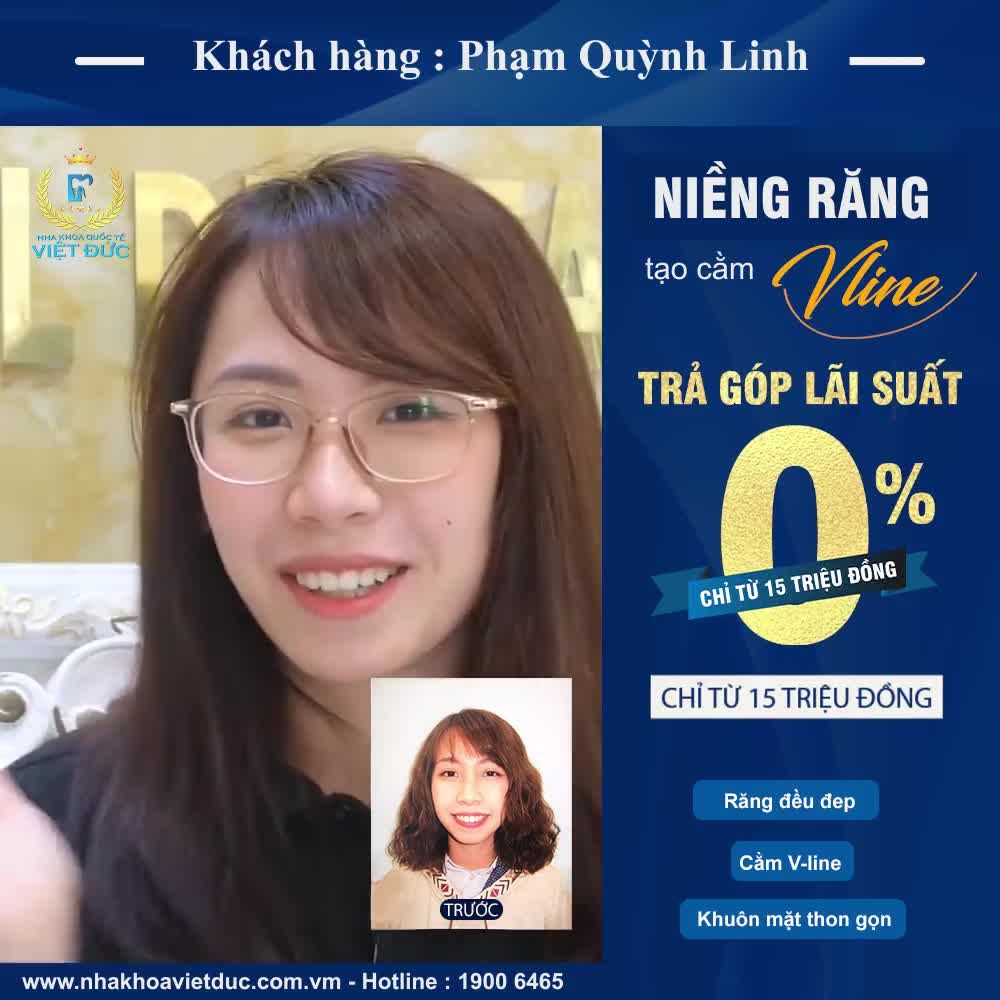 NIỀNG RĂNG TẠO CẰM VLINE GIÁ HẤP DẪN NHẤT TRẢ GÓP LÃI SUẤT 0%