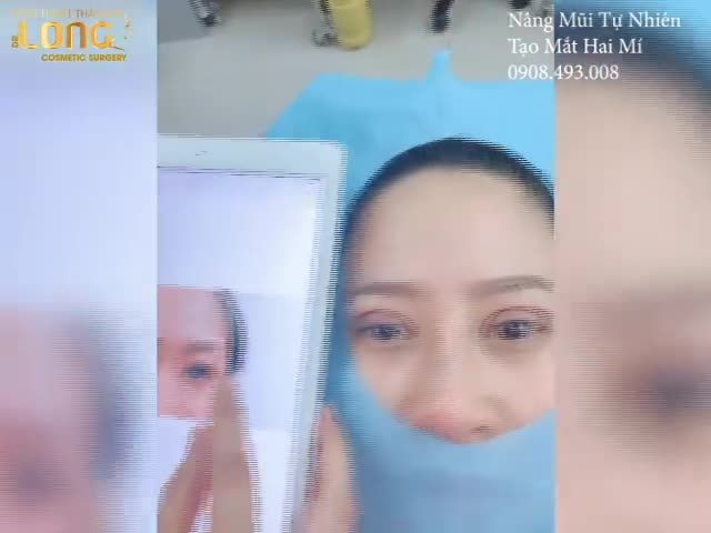 Sau Cơn Mưa Thì Trời Lại Sáng, Sau Khi Thẩm Mỹ Chắc Chắn Sẽ Đẹp Lên.