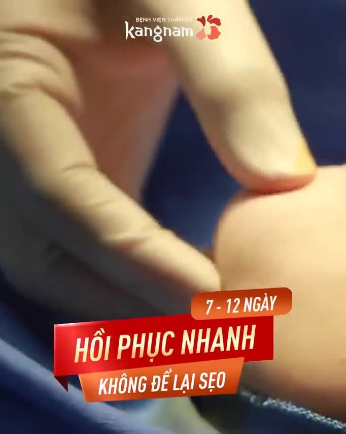 Độn cằm V-line - Cứu tinh cho cằm ngắn lẹm lệch