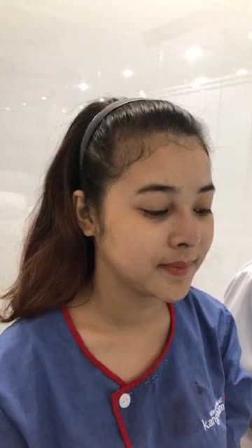 Khách hàng ngay sau khi Nâng mũi cấu trúc 4D tại Kangnam