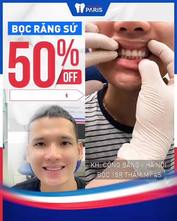 KẾT QUẢ BỌC SỨ 18R THẨM MỸ 4S KHÁCH HÀNG ĐẾN TỪ CẦU GIẤY (HN)